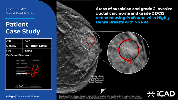 ProFound v4 Patient Case Study