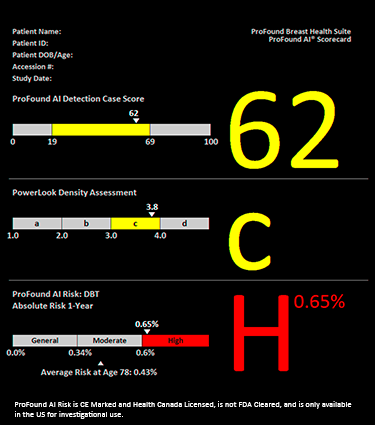 ProFound Scorecard